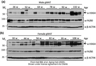 Anti-F4/80 antibody [CI:A3-1] used in Western Blot (WB). GTX26640