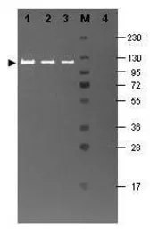 Anti-beta Galactosidase antibody (FITC) used in Western Blot (WB). GTX26641