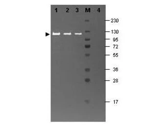Anti-beta Galactosidase antibody (FITC) used in Western Blot (WB). GTX26641