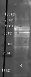 Anti-Fibrinogen antibody used in Western Blot (WB). GTX26666