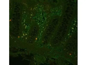 Anti-TNF alpha antibody used in IHC (Paraffin sections) (IHC-P). GTX26671