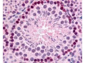 Anti-Gli2 antibody used in IHC (Paraffin sections) (IHC-P). GTX27195