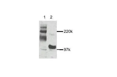 Anti-MAP3K14 antibody used in Western Blot (WB). GTX27204