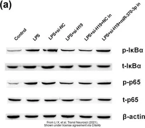 Anti-IKB alpha antibody used in Western Blot (WB). GTX27545