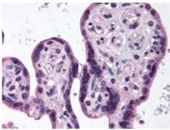 Anti-IKK beta antibody used in IHC (Paraffin sections) (IHC-P). GTX27611