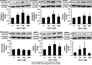 Anti-Collagen III antibody used in Western Blot (WB). GTX27778