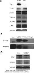 Anti-Collagen III antibody used in Western Blot (WB). GTX27778