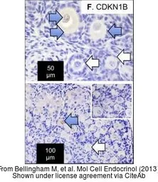 Anti-p27 Kip1 antibody used in Immunohistochemistry (IHC). GTX27961