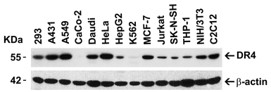 Anti-DR4 antibody used in Western Blot (WB). GTX28414
