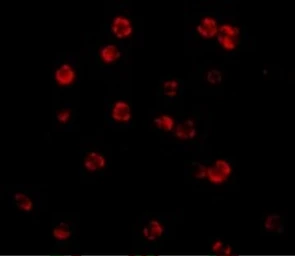 Anti-FLIP antibody used in Immunocytochemistry/ Immunofluorescence (ICC/IF). GTX28421