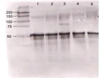 Anti-Angiopoietin 1 antibody used in Western Blot (WB). GTX28451