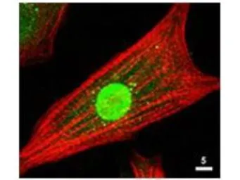 Anti-AKT antibody used in Immunocytochemistry/ Immunofluorescence (ICC/IF). GTX28805