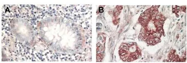 Anti-AKT antibody used in IHC (Paraffin sections) (IHC-P). GTX28805