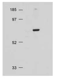 Anti-AKT antibody used in Western Blot (WB). GTX28805