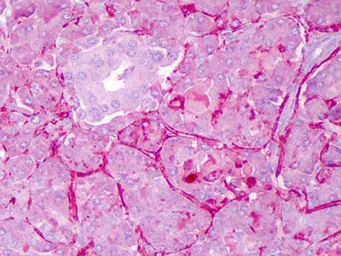 Anti-NOTCH1 antibody used in IHC (Paraffin sections) (IHC-P). GTX28925