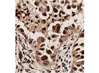 Anti-AKT (phospho Thr308) antibody used in IHC (Paraffin sections) (IHC-P). GTX28933