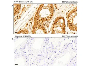 Anti-AKT (phospho Thr308) antibody used in IHC (Paraffin sections) (IHC-P). GTX28933