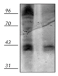 Anti-Phosphothreonine antibody used in Western Blot (WB). GTX29337