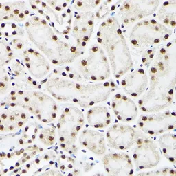 Anti-BAF53A antibody used in IHC (Paraffin sections) (IHC-P). GTX30021