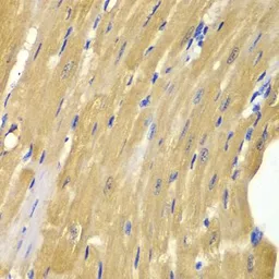 Anti-Adenylate kinase 1 antibody used in IHC (Paraffin sections) (IHC-P). GTX30037