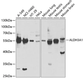 Anti-ALDH3A1 antibody used in Western Blot (WB). GTX30042