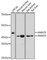 Anti-AMACR antibody used in Western Blot (WB). GTX30045