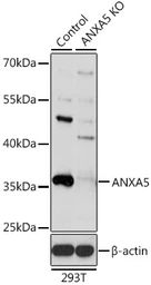 Anti-Annexin V antibody used in Western Blot (WB). GTX30049