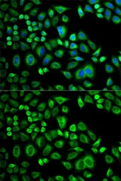 Anti-Apolipoprotein D antibody used in Immunocytochemistry/ Immunofluorescence (ICC/IF). GTX30058
