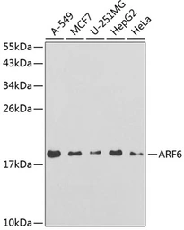 Anti-ARF6 antibody used in Western Blot (WB). GTX30062
