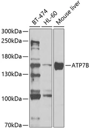 Anti-ATP7b antibody used in Western Blot (WB). GTX30077