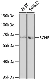 Anti-BCHE antibody used in Western Blot (WB). GTX30084
