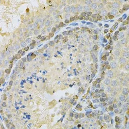 Anti-BUB1 antibody used in IHC (Paraffin sections) (IHC-P). GTX30097
