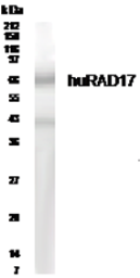 Anti-Rad17 antibody used in Western Blot (WB). GTX30134