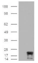 Anti-Survivin antibody [60.11] used in Western Blot (WB). GTX30241