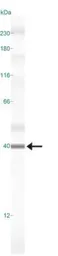 Anti-Caspase 3 antibody [CPP32 4-1-18] used in Western Blot (WB). GTX30246