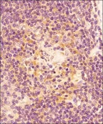 Anti-Caspase 3 antibody [CPP32 4-1-18] used in IHC (Paraffin sections) (IHC-P). GTX30246