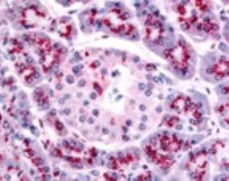 Anti-TERT antibody [2C4] used in IHC (Paraffin sections) (IHC-P). GTX30410