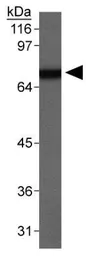 Anti-SR-BI antibody used in Western Blot (WB). GTX30467