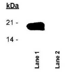 Anti-Survivin (phospho Thr34) antibody used in Western Blot (WB). GTX30488
