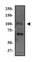 Anti-WNK4 antibody used in Western Blot (WB). GTX30604