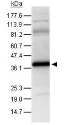 Anti-HIF1AN antibody used in Western Blot (WB). GTX30646