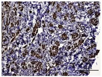 Anti-HIF1 alpha antibody used in IHC (Paraffin sections) (IHC-P). GTX30647