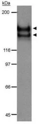 Anti-VEGF Receptor 2 antibody used in Western Blot (WB). GTX30654