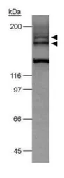 Anti-VEGF Receptor 2 antibody used in Western Blot (WB). GTX30654