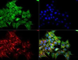 Anti-VEGF Receptor 2 antibody used in Immunocytochemistry/ Immunofluorescence (ICC/IF). GTX30654