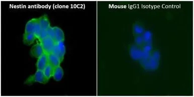 Anti-Nestin antibody [10C2] used in Immunocytochemistry/ Immunofluorescence (ICC/IF). GTX30671