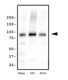 Anti-KIF2A antibody used in Western Blot (WB). GTX30691