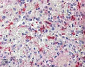 Anti-Heme Oxygenase 1 antibody used in IHC (Paraffin sections) (IHC-P). GTX30748