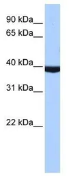 Anti-PAX2 antibody, Internal used in Western Blot (WB). GTX30760