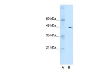 Anti-GDI2 antibody, C-term used in Western Blot (WB). GTX30782